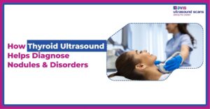 How Thyroid Ultrasound Helps Diagnose Nodules & Disorders