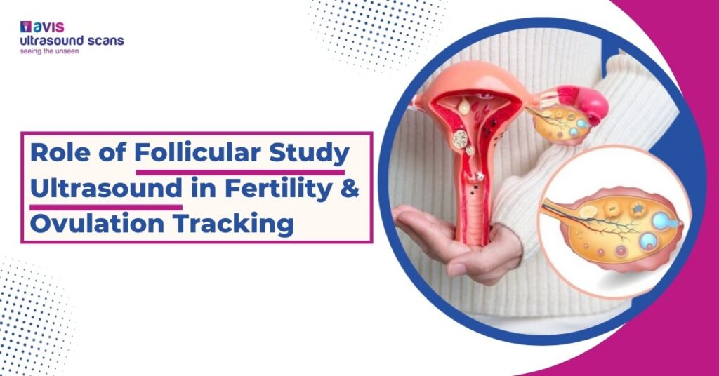 Role of Follicular Study Ultrasound in Fertility & Ovulation Tracking