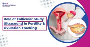 Role of Follicular Study Ultrasound in Fertility & Ovulation Tracking