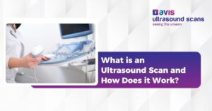 What Is an Ultrasound Scan and How Does It Work