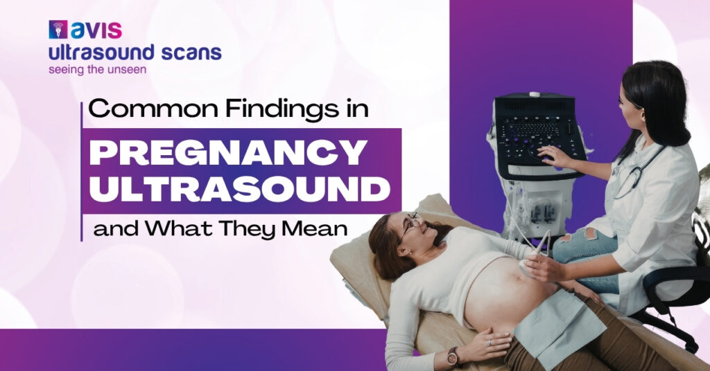 Common Findings in Early Pregnancy Ultrasound and What They Mean