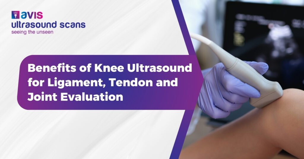 Benefits of Knee Ultrasound for Ligament, Tendon and Joint Evaluation