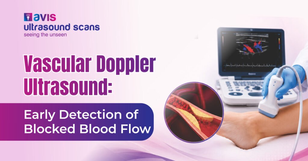 Vascular Doppler Ultrasound Early Detection of Blocked Blood Flow