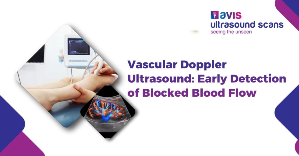 Vascular Doppler Ultrasound: Early Detection of Blocked Blood Flow