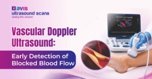 Vascular Doppler Ultrasound Early Detection of Blocked Blood Flow