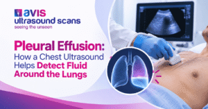 Pleural Effusion How a Chest Ultrasound Helps Detect Fluid Around the Lungs