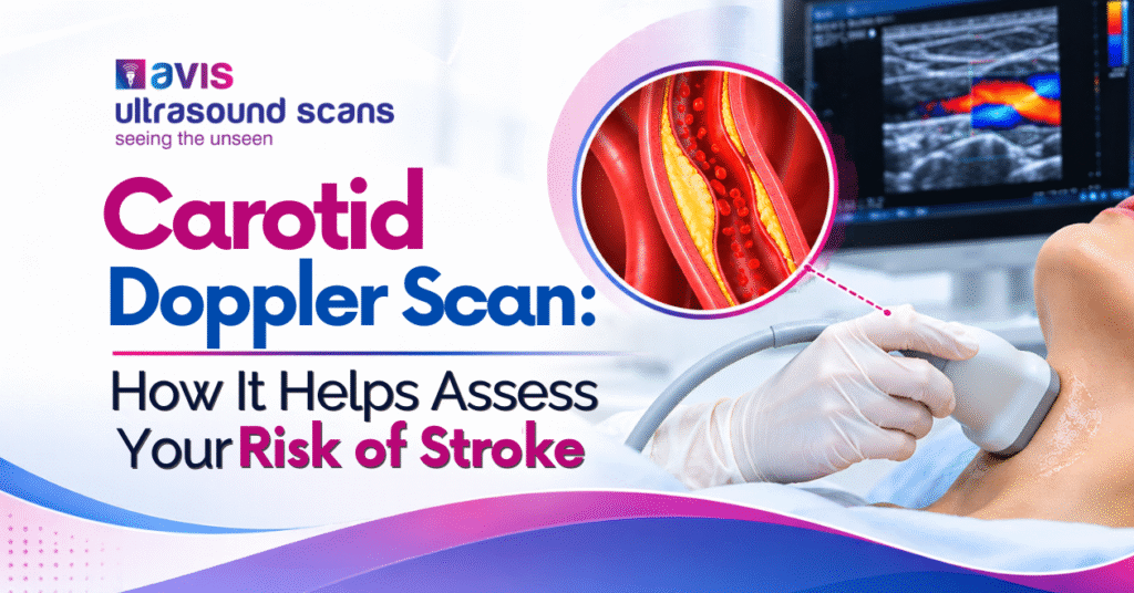 Carotid Doppler Scan: How It Helps Assess Your Risk of Stroke